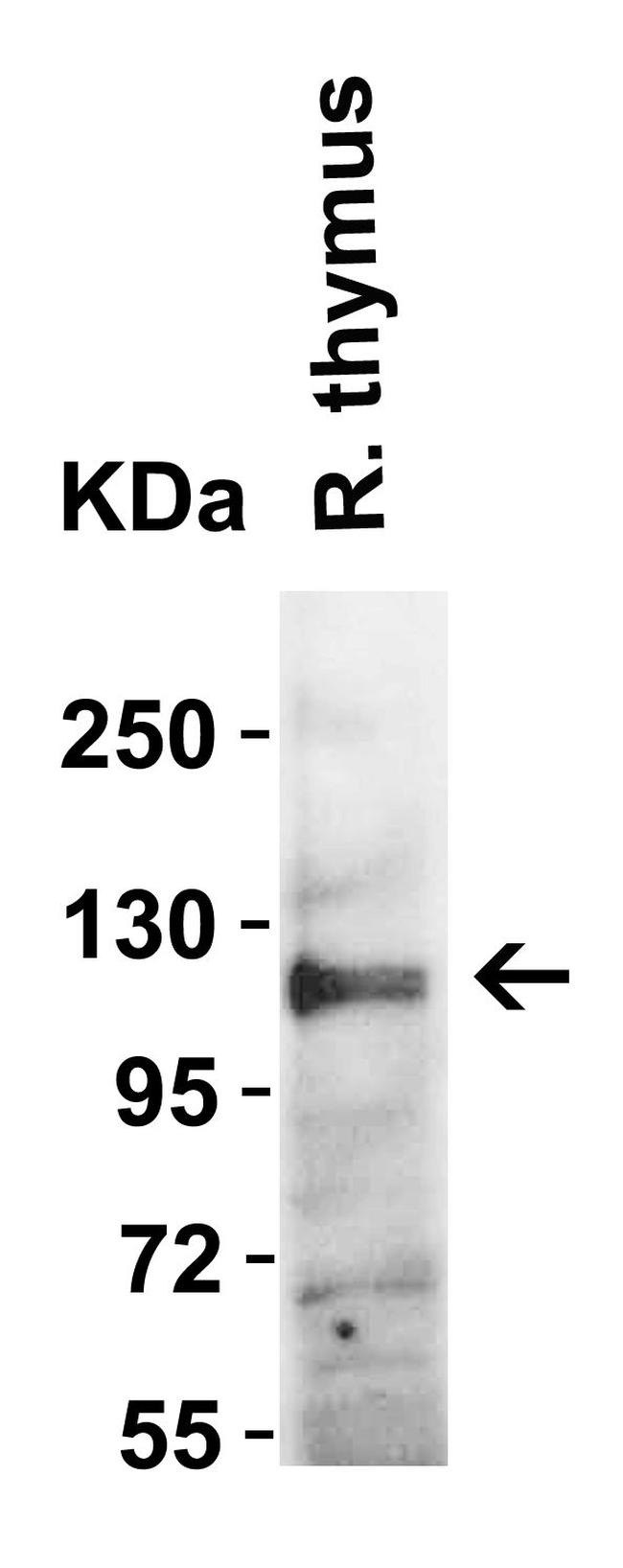 ACE2 Antibody in Western Blot (WB)