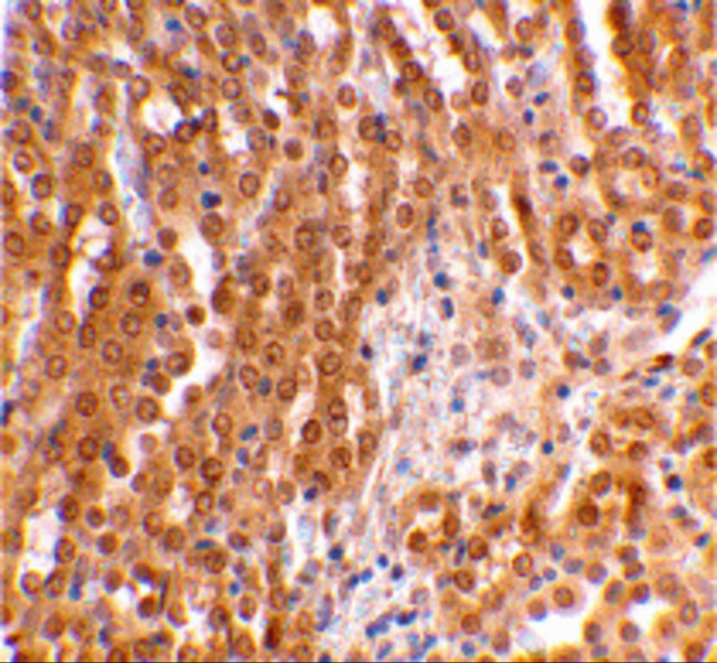 TICAM2 Antibody in Immunohistochemistry (IHC)