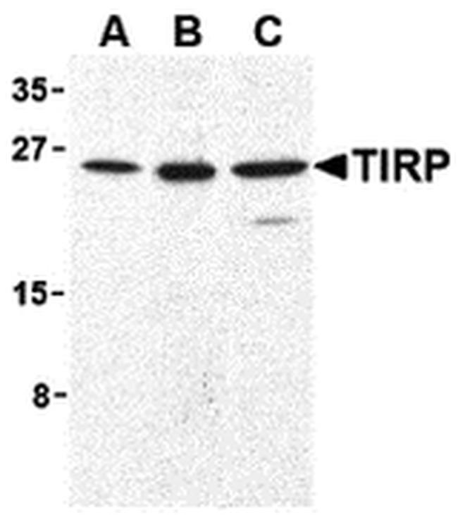 TICAM2 Antibody in Western Blot (WB)