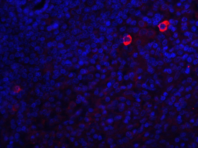 Caspase 8 Antibody in Immunohistochemistry (IHC)