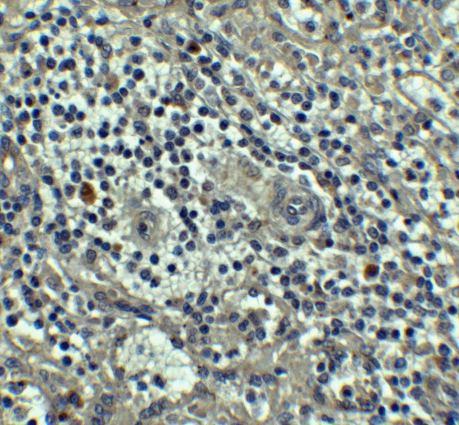 Caspase 8 Antibody in Immunohistochemistry (IHC)