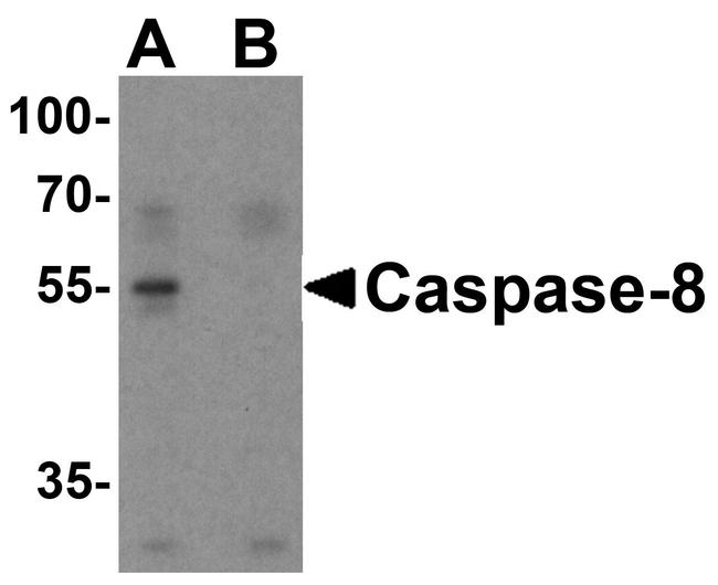 Caspase 8 Antibody in Western Blot (WB)