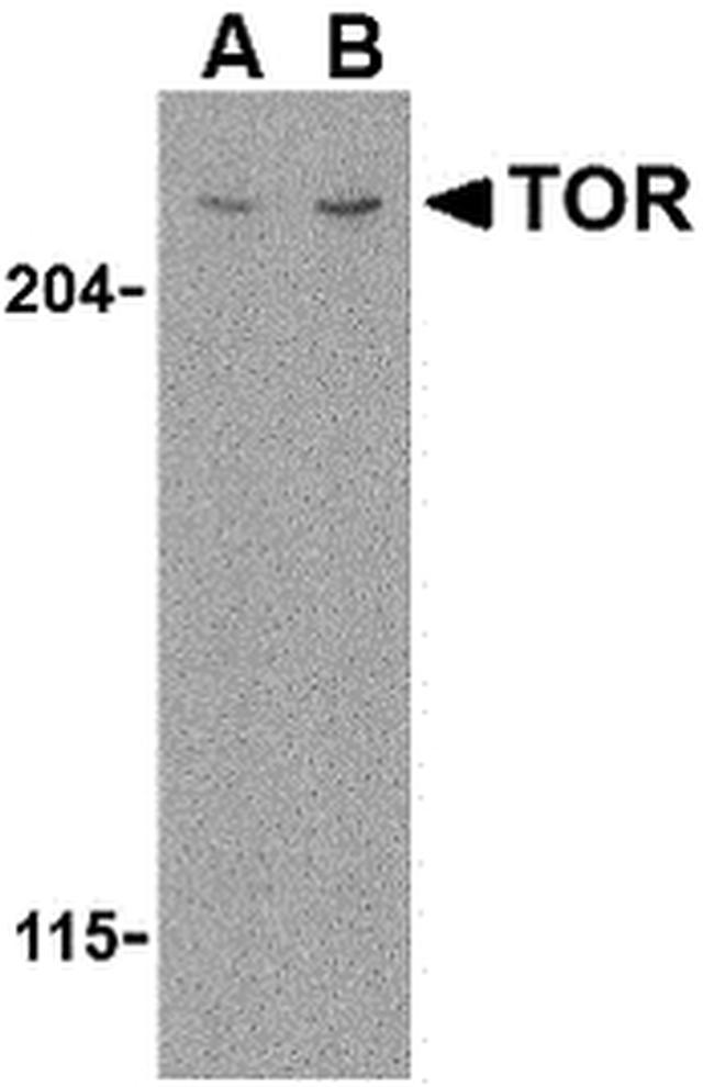 mTOR Antibody in Western Blot (WB)