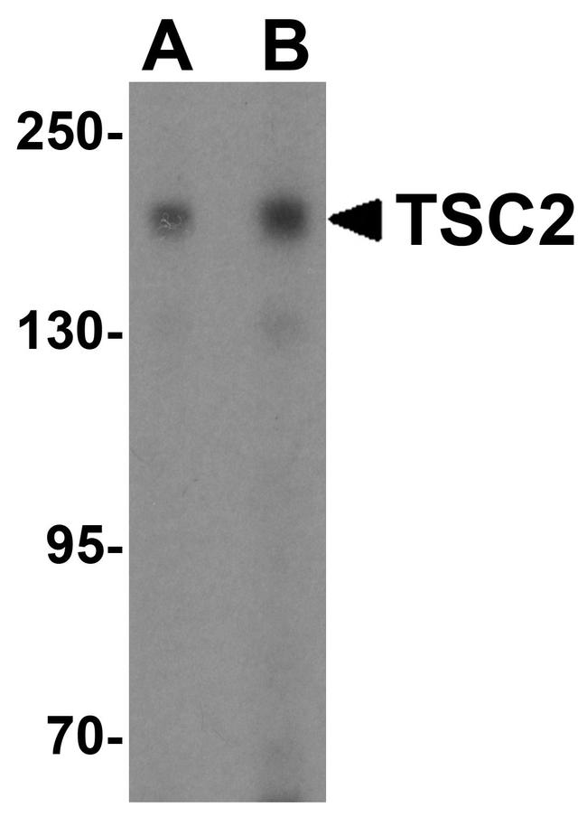 TSC2 Antibody in Western Blot (WB)