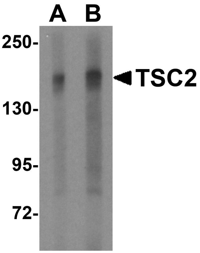 TSC2 Antibody in Western Blot (WB)