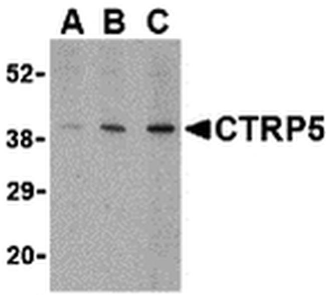 CTRP5 Antibody in Western Blot (WB)