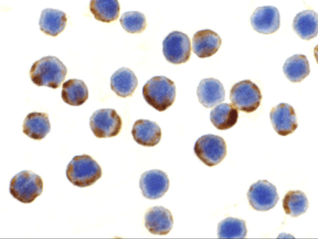 ATG7 Antibody in Immunocytochemistry (ICC/IF)