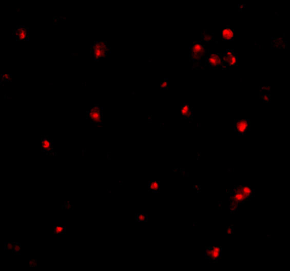 ATG7 Antibody in Immunocytochemistry (ICC/IF)