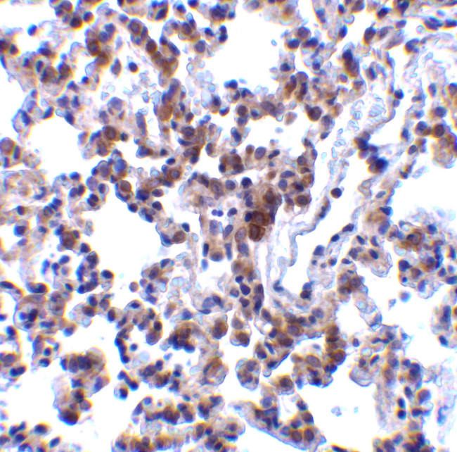 BAP31 Antibody in Immunohistochemistry (Paraffin) (IHC (P))