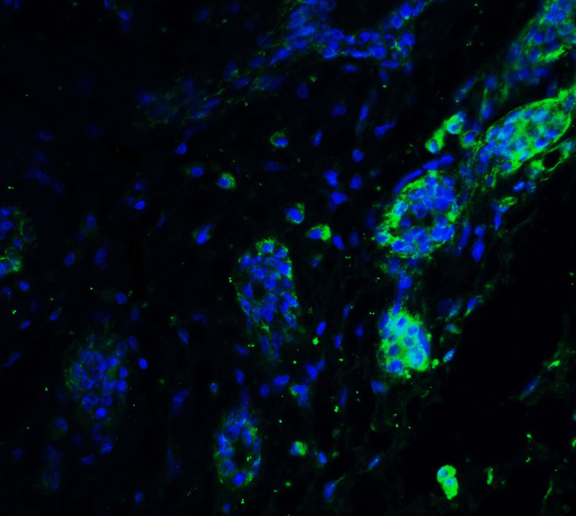 ATF6 Antibody in Immunohistochemistry (IHC)