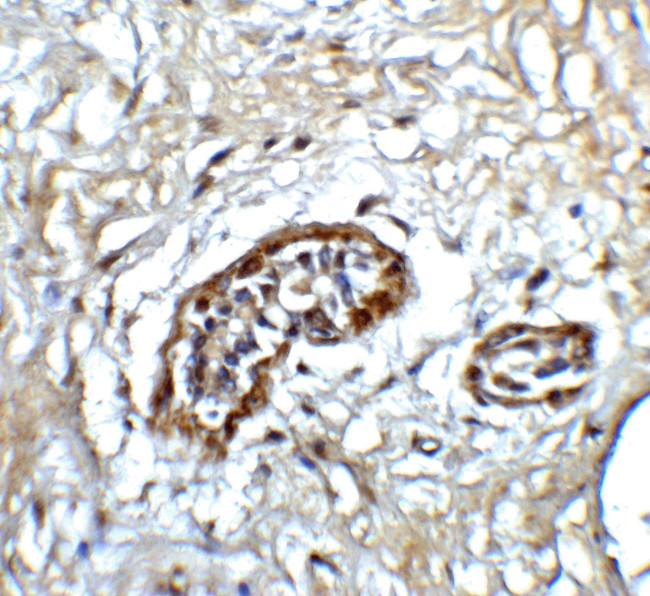 ATF6 Antibody in Immunohistochemistry (IHC)