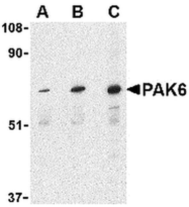 PAK6 Antibody in Western Blot (WB)
