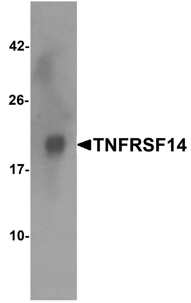 TNFRSF14 Antibody in Western Blot (WB)