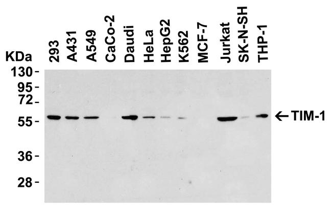 TIM-1 Antibody in Western Blot (WB)