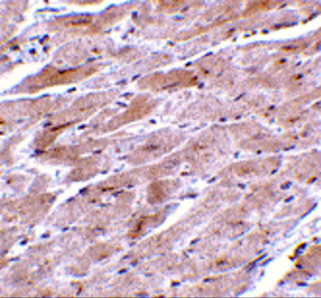 TRPC3 Antibody in Immunohistochemistry (IHC)