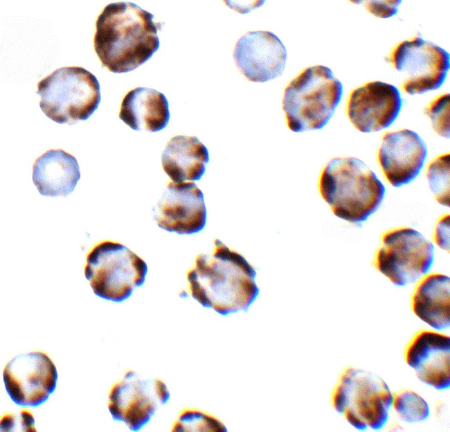 TRPC6 Antibody in Immunocytochemistry (ICC/IF)