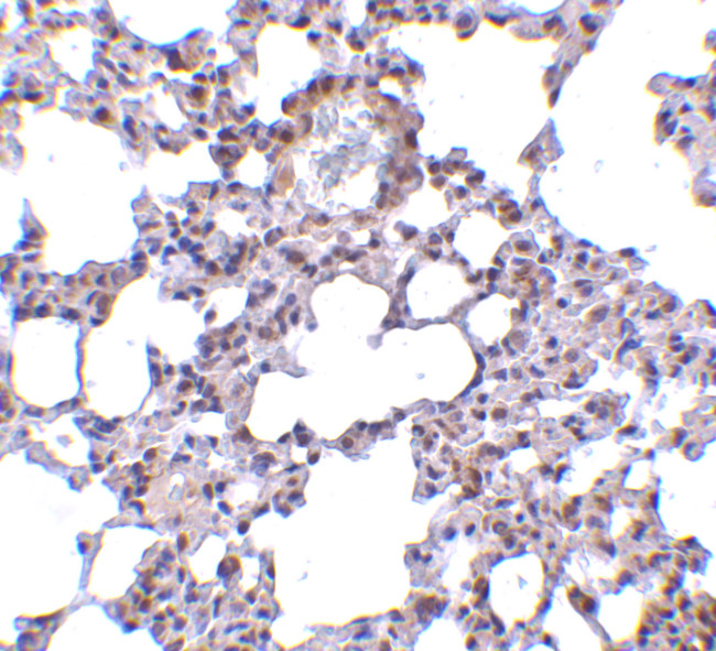 TRPC6 Antibody in Immunohistochemistry (IHC)