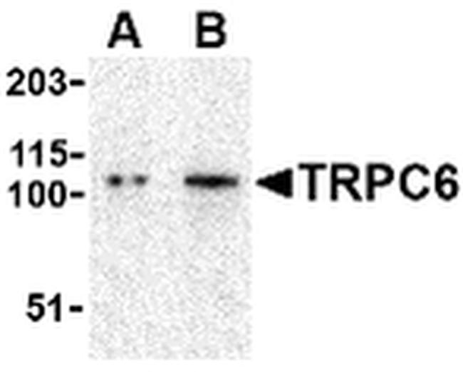 TRPC6 Antibody in Western Blot (WB)