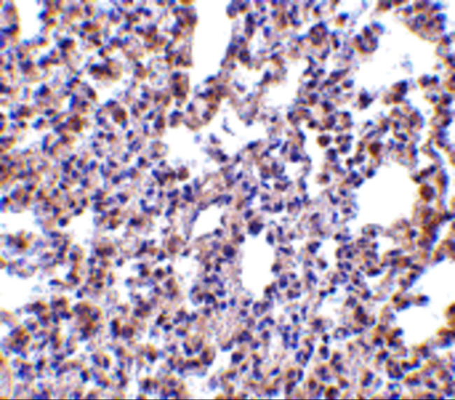 PKR Antibody in Immunohistochemistry (Paraffin) (IHC (P))