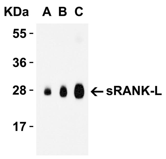 CD254 (RANK Ligand) Antibody in Western Blot (WB)