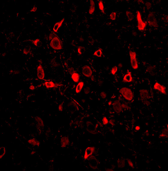 TSLP Antibody in Immunohistochemistry (PFA fixed) (IHC (PFA))