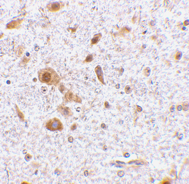 TSLP Antibody in Immunohistochemistry (Paraffin) (IHC (P))