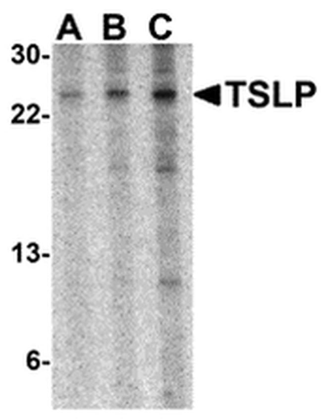 TSLP Antibody in Western Blot (WB)