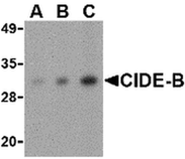 CIDEB Antibody in Western Blot (WB)