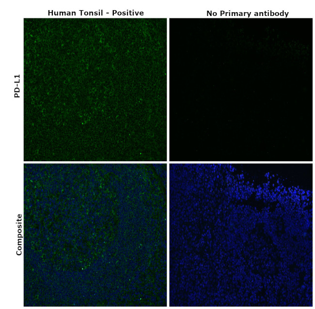 PD-L1 Antibody in Immunohistochemistry (Paraffin) (IHC (P))