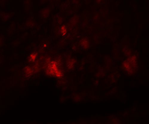 PD-L1 Antibody in Immunohistochemistry (Paraffin) (IHC (P))