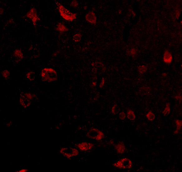 TIGAR Antibody in Immunocytochemistry (ICC/IF)