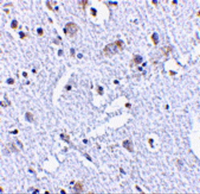 TIGAR Antibody in Immunohistochemistry (IHC)