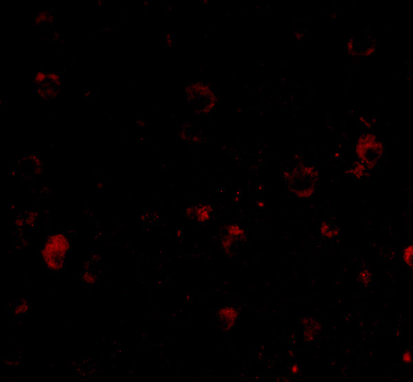 BRSK1 Antibody in Immunocytochemistry (ICC/IF)