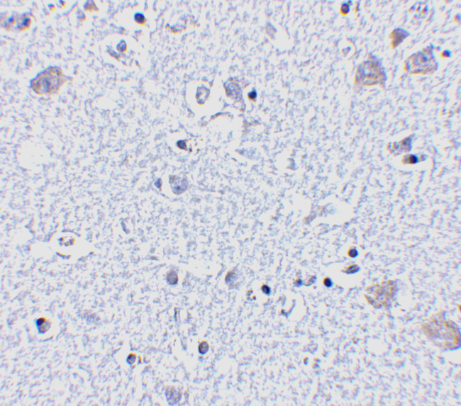 BRSK1 Antibody in Immunohistochemistry (IHC)