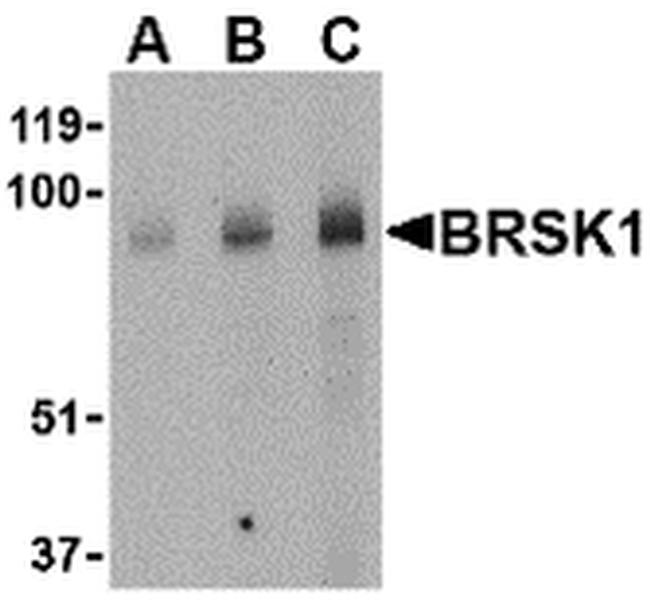 BRSK1 Antibody in Western Blot (WB)