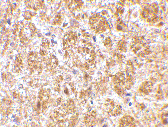 DARC Antibody in Immunohistochemistry (IHC)