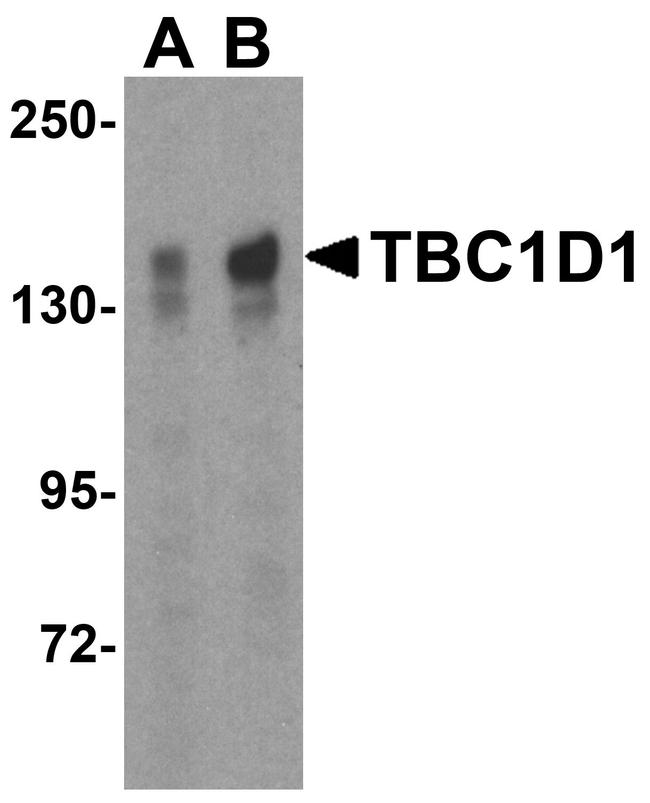 TBC1D1 Antibody in Western Blot (WB)