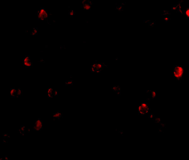 TDP-43 Antibody in Immunocytochemistry (ICC/IF)