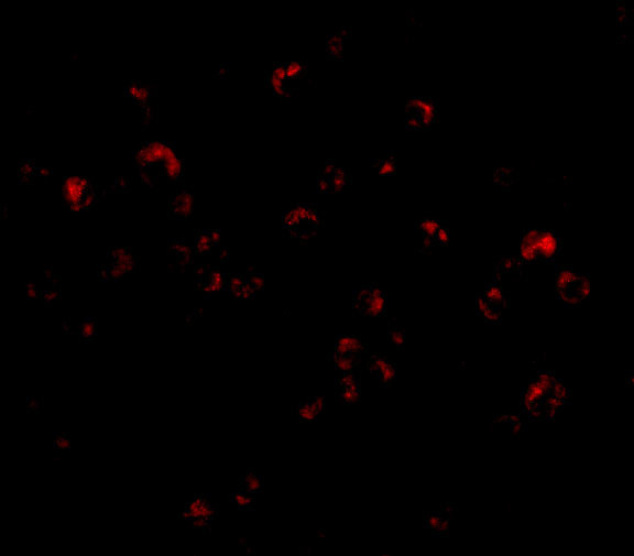 TRIM25 Antibody in Immunocytochemistry (ICC/IF)