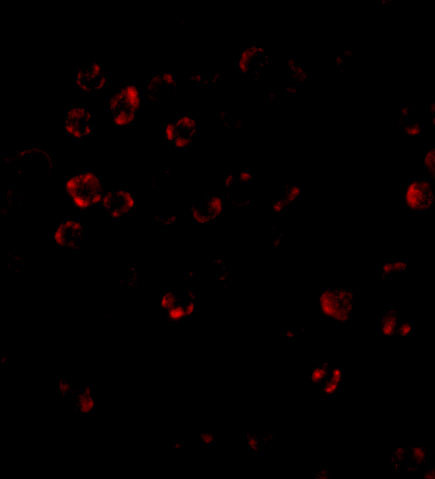 DISC1 Antibody in Immunocytochemistry (ICC/IF)