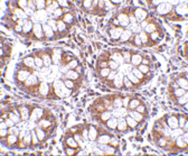 CD248 Antibody in Immunohistochemistry (Paraffin) (IHC (P))