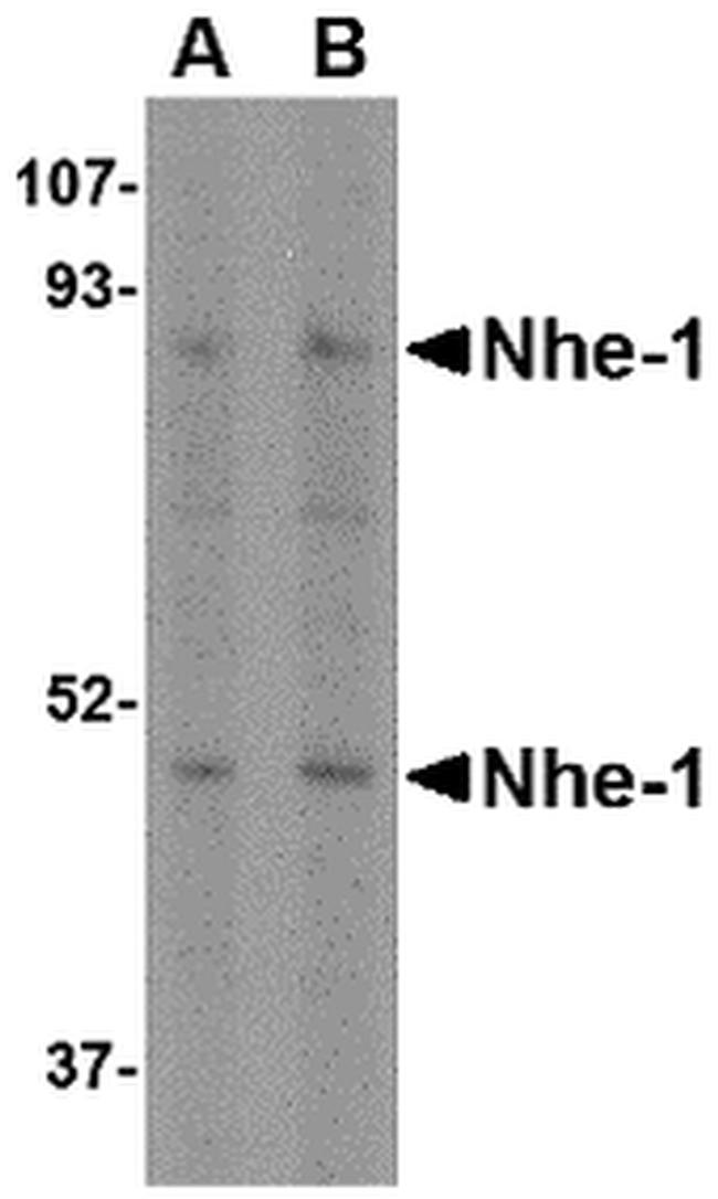 Nhe-1 Antibody in Western Blot (WB)
