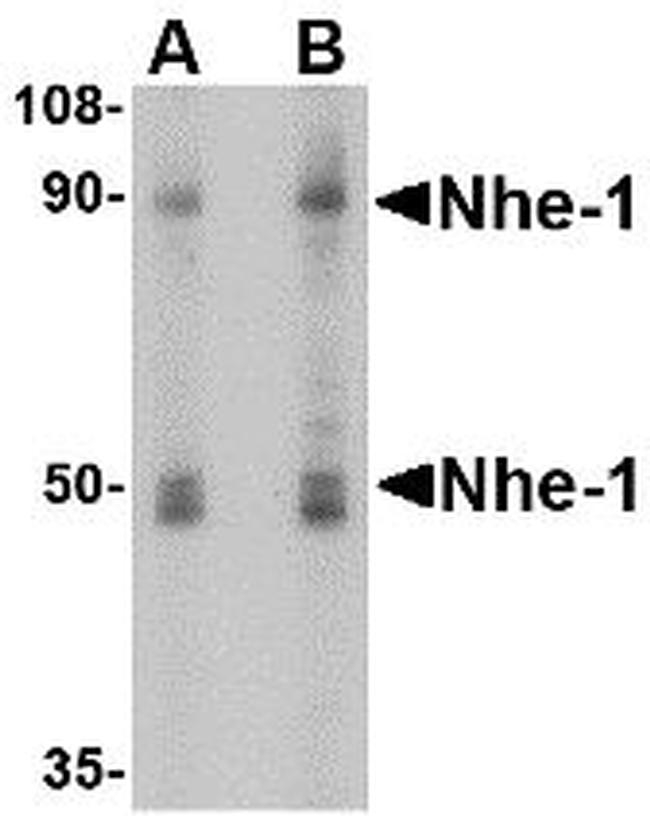 Nhe-1 Antibody in Western Blot (WB)