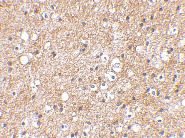 SP110 Antibody in Immunohistochemistry (IHC)