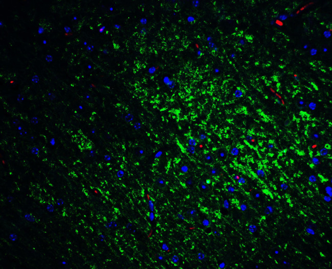 SLITRK1 Antibody in Immunohistochemistry (IHC)