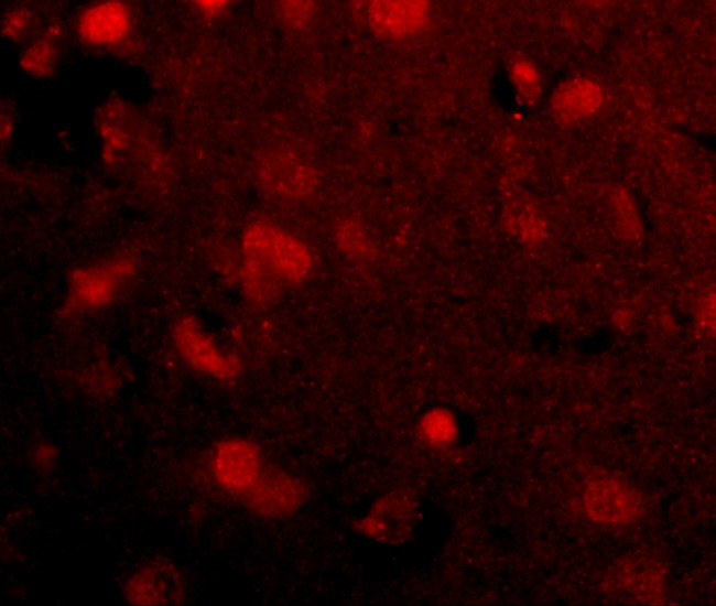 SLITRK4 Antibody in Immunohistochemistry (IHC)