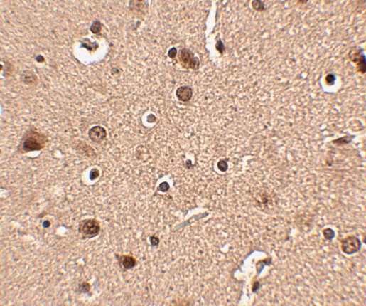 SLITRK4 Antibody in Immunohistochemistry (IHC)