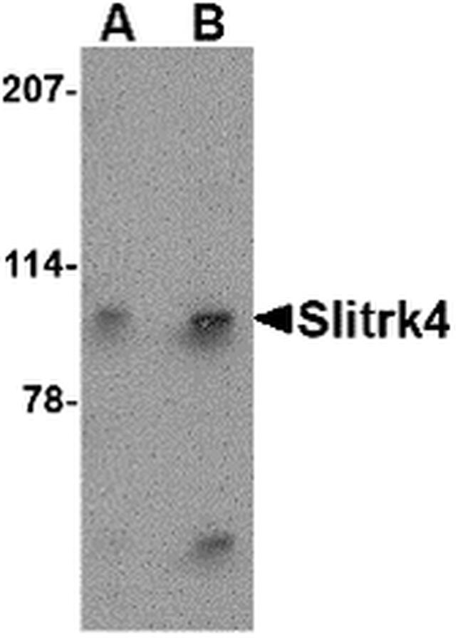 SLITRK4 Antibody in Western Blot (WB)