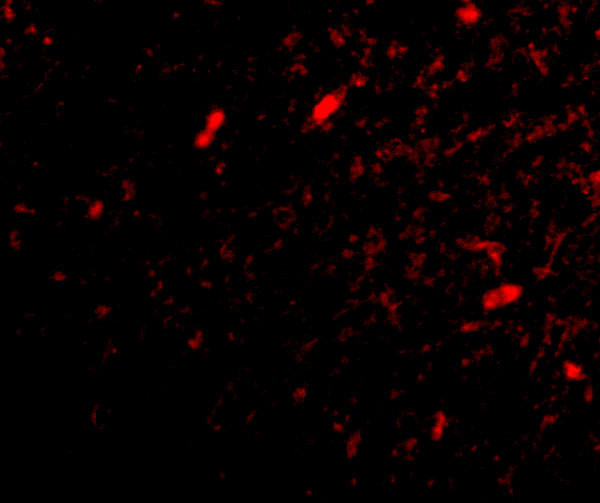 FBXL20 Antibody in Immunohistochemistry (IHC)