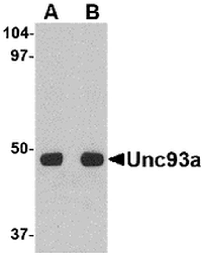 UNC93A Antibody in Western Blot (WB)